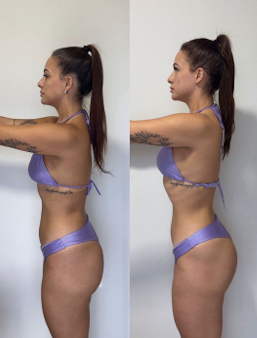 Evolução corporal — antes e depois, consultoria BG Team